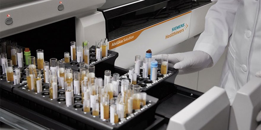 Koronavirüse karşı bağışıklık ölçen test