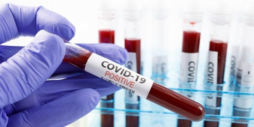 Japonya'da 21 kişi daha koronavirüsten öldü