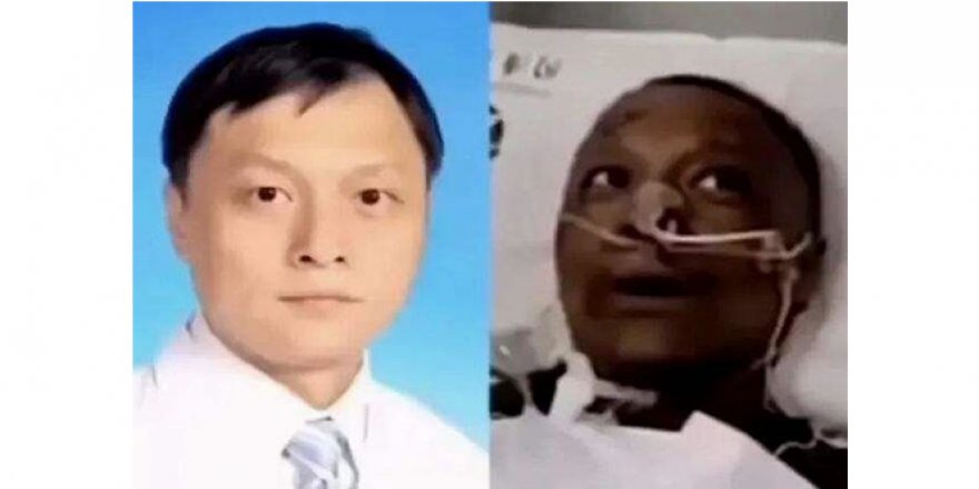 Korona nedeniyle ten rengi değişen Çinli doktor hayatını kaybetti